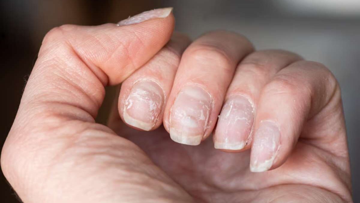 Réparer ongles abimé après faux ongle