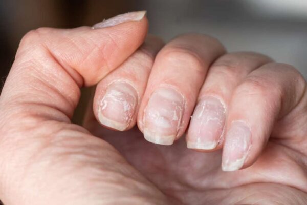 Réparer ongles abimé après faux ongle
